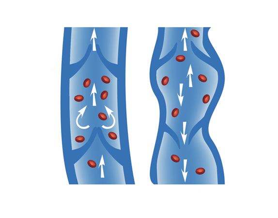 angiologie gefässkrankheiten venen